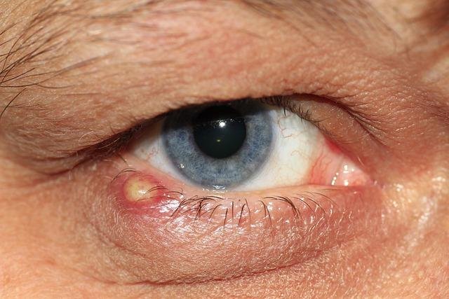 Signs of Chronic Inflammation