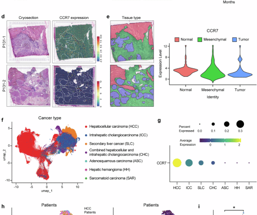 Differential expression pattern of CC chemokine receptor 7 guides precision treatment of hepatocellular carcinoma