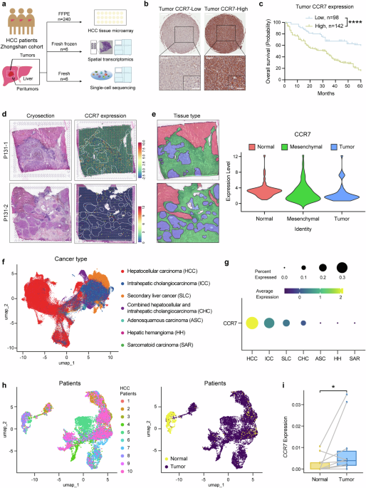 Differential expression pattern of CC chemokine receptor 7 guides precision treatment of hepatocellular carcinoma