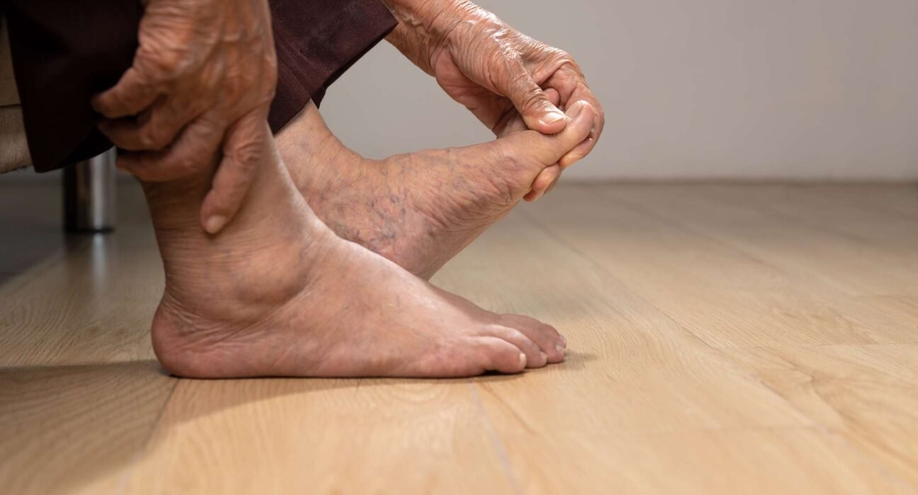 How Does Psoriatic Arthritis Affect Your Feet?