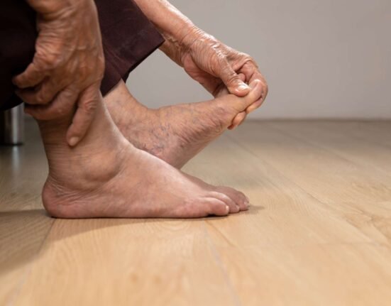 How Does Psoriatic Arthritis Affect Your Feet?