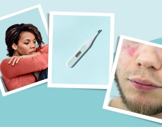 Lupus Symptoms