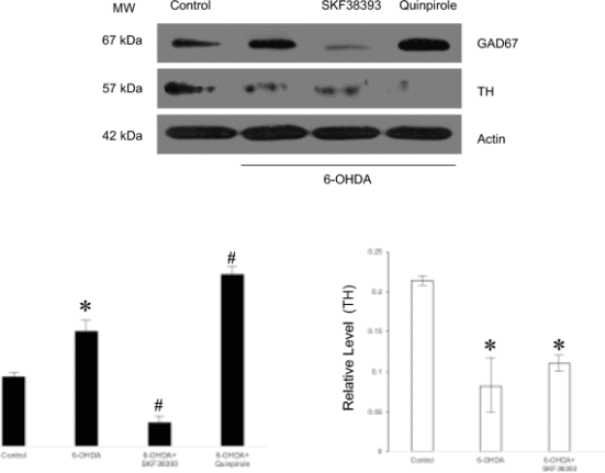 SKF-38393 regulates the expression of glutamic acid decarboxylase 67 via heparanase-1 in 6-hydroxydopamine-induced neurodegeneration