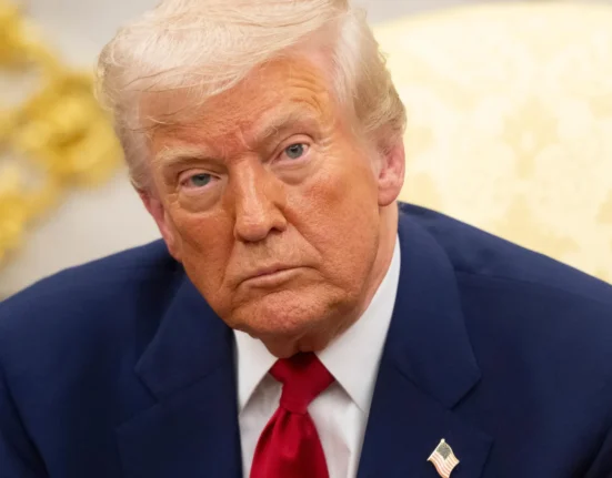 Why Trump’s leg swelling could be a warning sign for millions